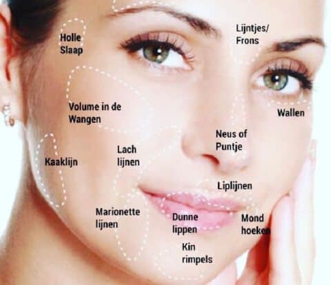 Botox Voorhoofd Aesthetic Medico Center botox-voorhoofd-aesthetic-medico-center